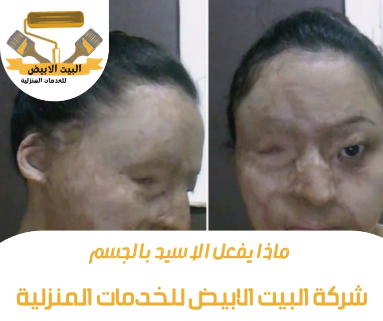 ماذا يفعل الاسيد بالجسم